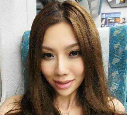 面部吸脂  比之前更加甜美漂亮啦