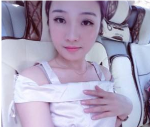 北京圣嘉新医疗美容门诊部朱昊医生割双眼皮案例：实现美丽的自己 - 珍美网