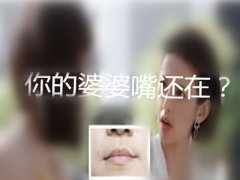 【整形常识】垫下巴婆婆嘴多久消失？