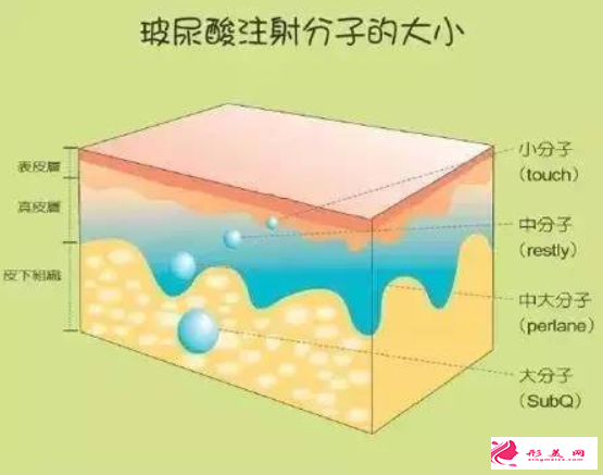 玻尿酸填充面部痛不痛