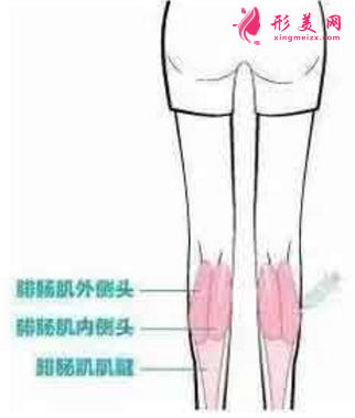 注射瘦腿针1个月，谈谈效果