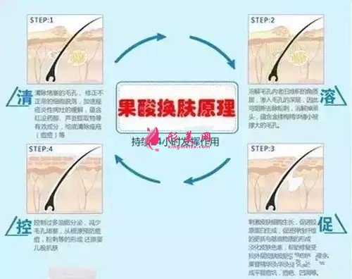 果酸换肤需要多少钱