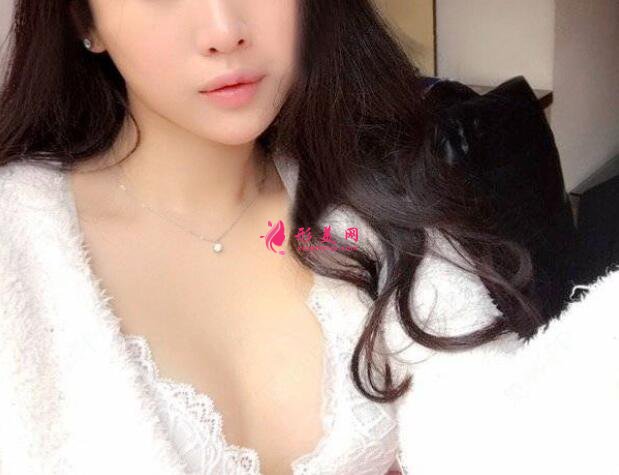 隆胸术后30天