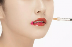 注射瘦脸针价格是多少？