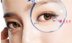 开眼角整形有什么好处？