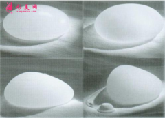 假体隆胸哪里做得比较好？