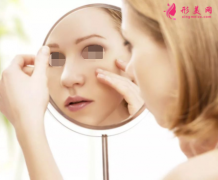 激光祛斑需要怎么护理？