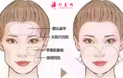 自体脂肪填充脸部恢复时间长不长？