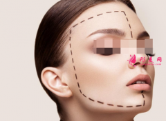 面部填充脂肪可维持多久？