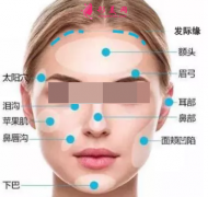 面部脂肪填充多久可以消肿？