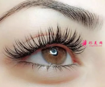 抽脂双眼皮多少钱？