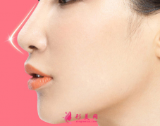 隆鼻手术一般需要多少钱?