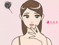 如何改善脸上的色斑？