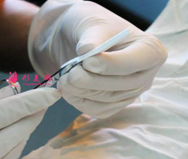 膨体隆鼻手术多少钱？