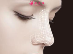 软骨隆鼻有什么危害？