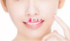 激光祛斑费用价格是多少?