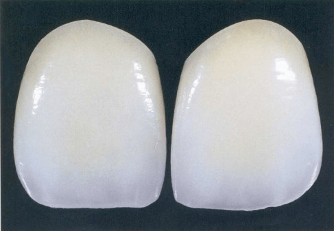 公办医院牙科贵还是私立诊所贵,要选择看牙便宜一些的。