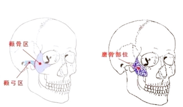 首尔丽格做轮廓谁好?石润