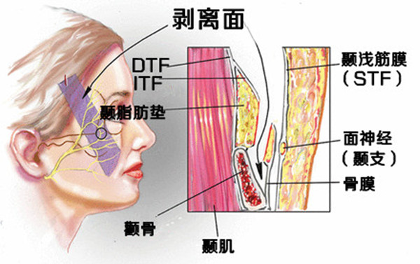 北京面部提升哪位医生好?李晓东?祝东升?穆宝安?还是杨大平