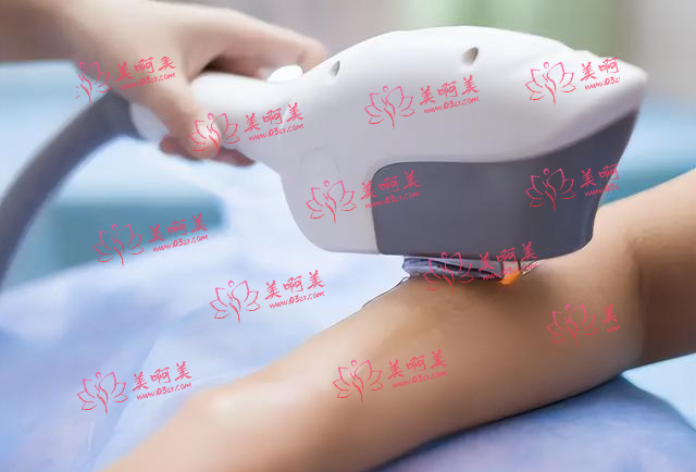 2023年昌都市江达县冰点脱毛技术医生盘点