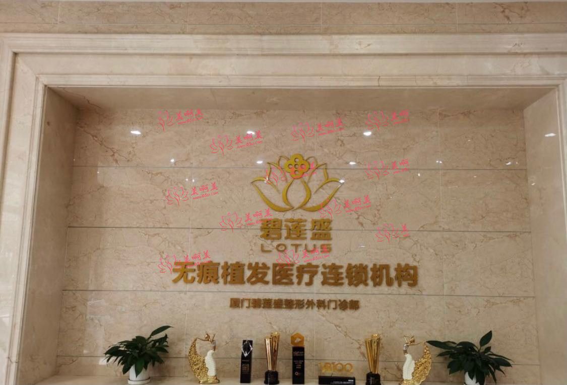 碧莲盛植发医院是私立的吗？怎么样？