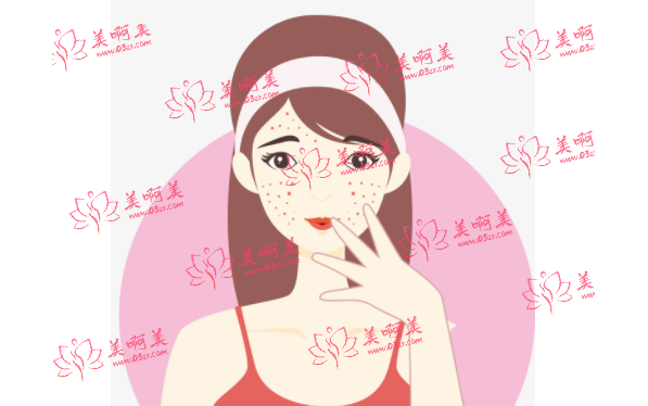 安徽省点阵激光是怎么收费的？它的价格影响因素是什么？