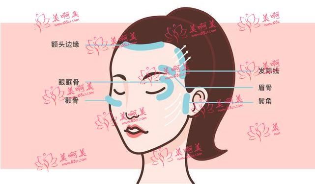 面部微创提升之后如何护理才能恢复得快？及适合人群