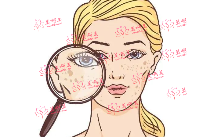 长斑的原因是什么？有什么快速有效地祛斑方法吗？