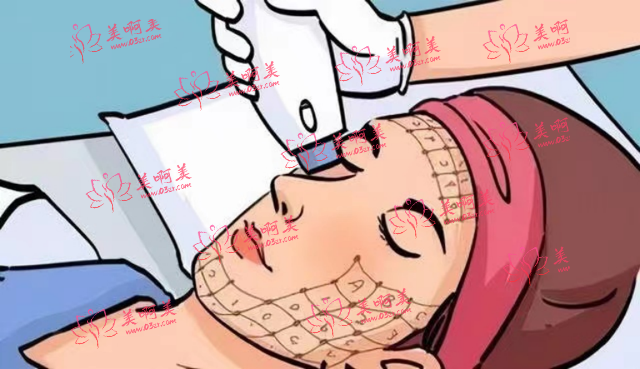 全脸做一次热玛吉五代需要多少?北京、上海、深圳等地收费查询!