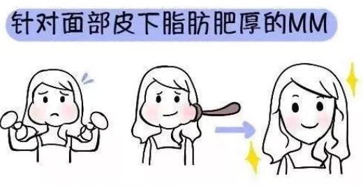 去颊脂垫手术安全吗？影响价格的因素是什么？