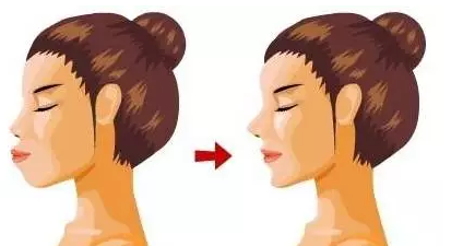 潍坊与上颌骨矫正的价格有关的影响因素是什么？