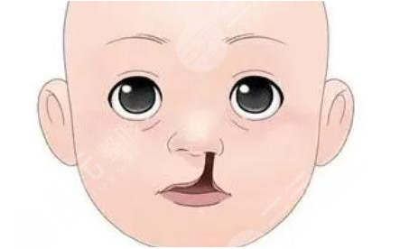 忻州市唇裂手术医生实力排行榜榜全网揭秘！附项目价格表