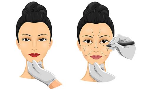 魔法超拉皮可以维持多久?影响价格的因素有哪些? 魔法超拉皮可以维持多久?影响价格的因素有哪些?