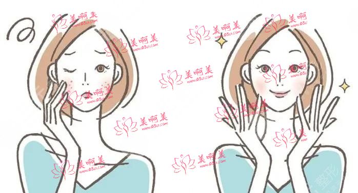 激光祛斑有效吗？会不会反弹？有什么护理建议吗？