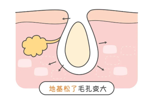 柳州中医医院整形科怎么样？缩毛孔收费贵不贵？附案例分享！