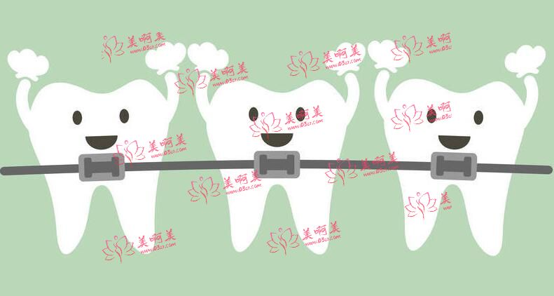 牙齿正畸是要去牙科吗?公立医院好还是去私立医院好?