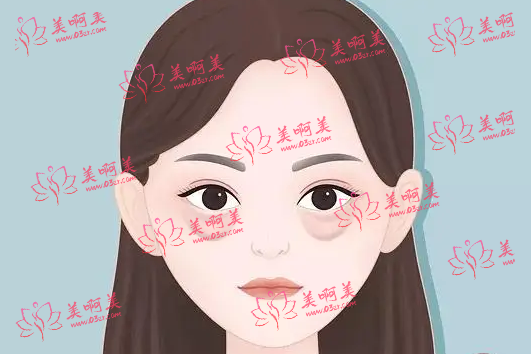 成都健丽医美是正规医院吗？医生技术、项目优势、口碑一览！