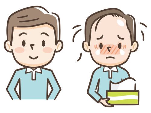 脂溢性脱发的症状有哪些？形成原因是？怎么恢复发量？