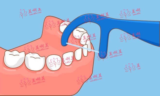 牙齿缝隙大有什么好的方法吗？怎样保持口腔健康？