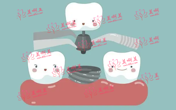 上海三甲医院口腔科价格详情！含种植牙/正畸等热门项目!