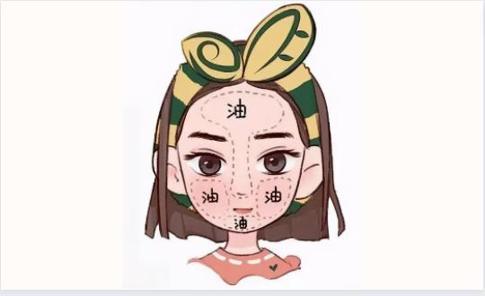 油性皮肤应该怎样选择护肤品？先来看看油皮的特点吧！