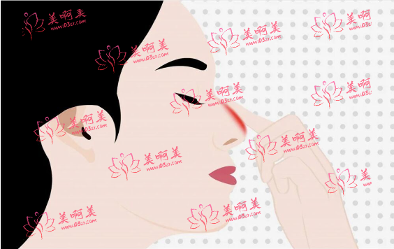 超肋鼻30000价格合理吗?影响费用的因素有哪些?维持时间多久? 超肋鼻30000价格合理吗?影响费用的因素有哪些?维持时间多久?