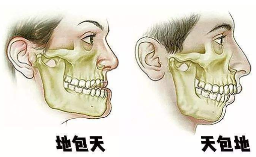 正颌手术是否有风险？选对医院很靠谱！真人整形案例分享！