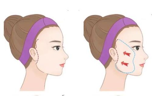 北京八大处整形很出名!拉皮手术技术超赞!来看看案例和医生信息吧! 北京八大处整形很出名!拉皮手术技术超赞!来看看案例和医生信息吧!