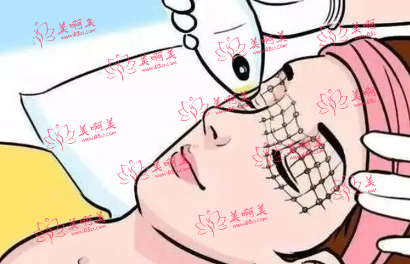 光子嫩肤价格一般是多少?盘点光子嫩肤的优缺点! 光子嫩肤价格一般是多少?盘点光子嫩肤的优缺点!