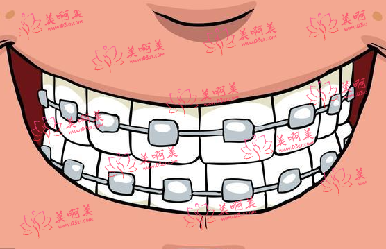 承德名士口腔牙齿矫正怎么样?价格合理,技术先进,医生靠谱! 承德名士口腔牙齿矫正怎么样?价格合理,技术先进,医生靠谱!