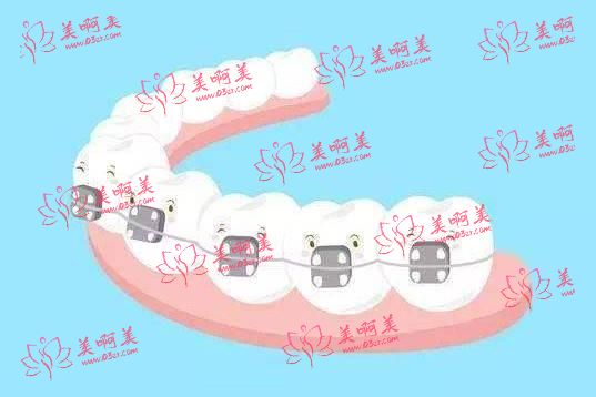 承德名士口腔牙齿矫正怎么样?价格合理,技术先进,医生靠谱! 承德名士口腔牙齿矫正怎么样?价格合理,技术先进,医生靠谱!
