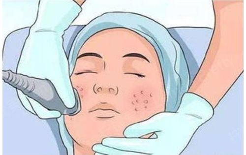 杭州时光整形皮秒激光怎么样?效果很不错，医生技术到位！