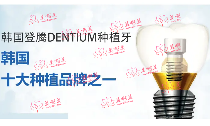 韩国进口种植牙常见知名品牌盘点！来看看品牌价格信息！