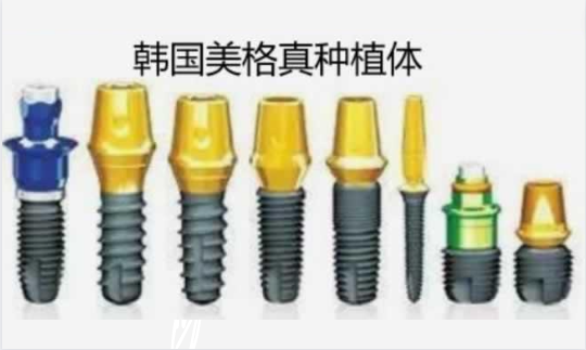 韩国进口种植牙常见知名品牌盘点！来看看品牌价格信息！